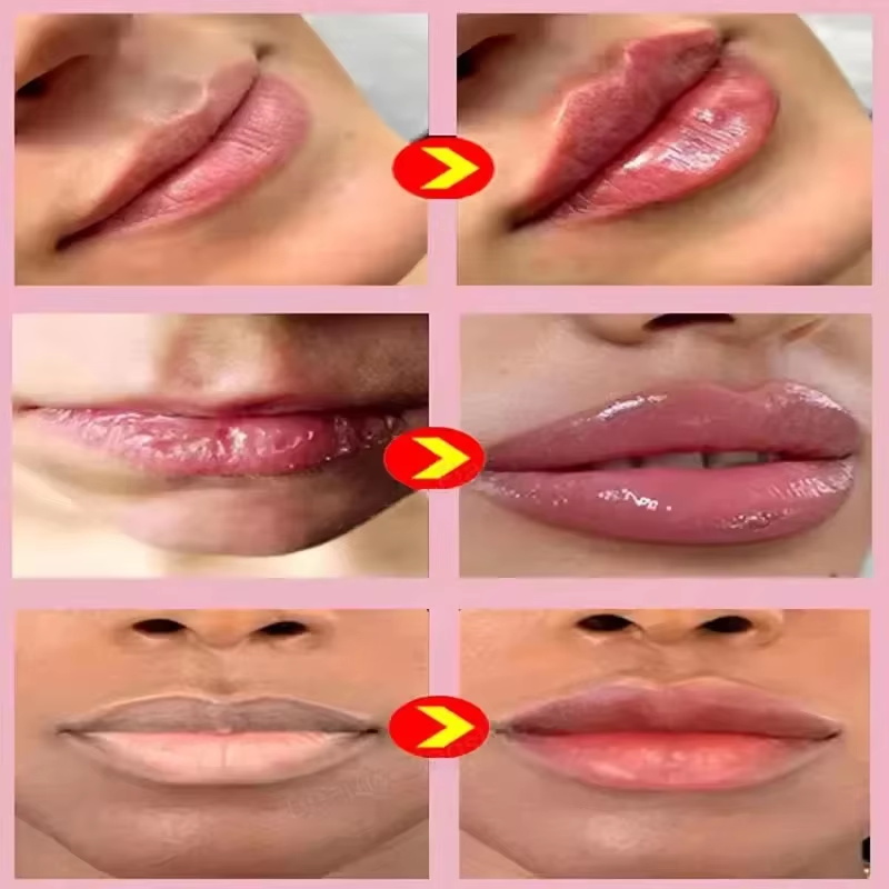 Minyak Pembesar Bibir Instan,  - Lip Gloss Plumping ulasan dan harga
