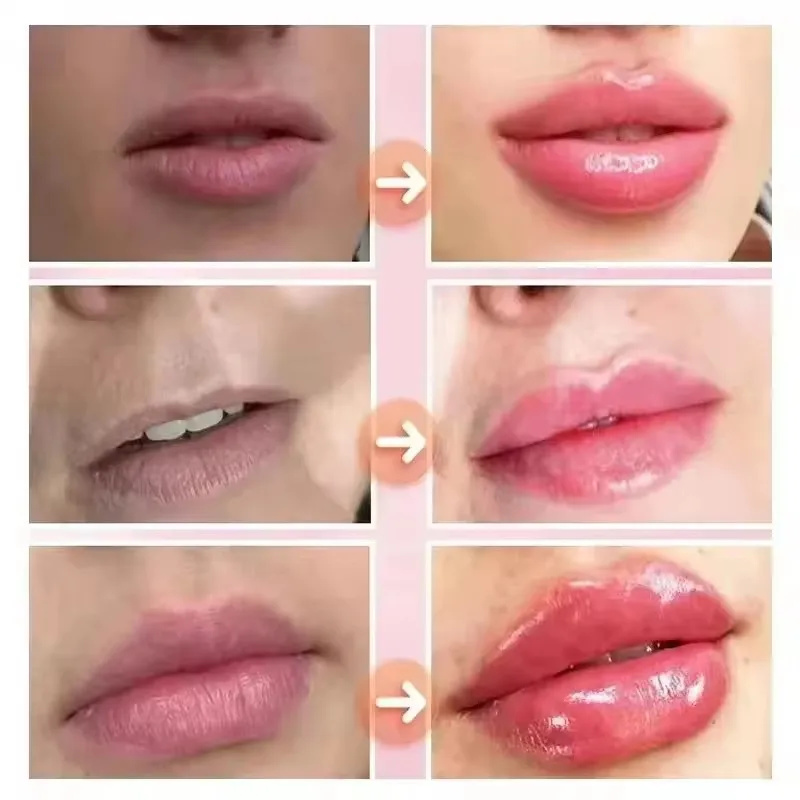 Minyak Esensial Pengencang Bib - Lip Gloss Plumping ulasan dan harga