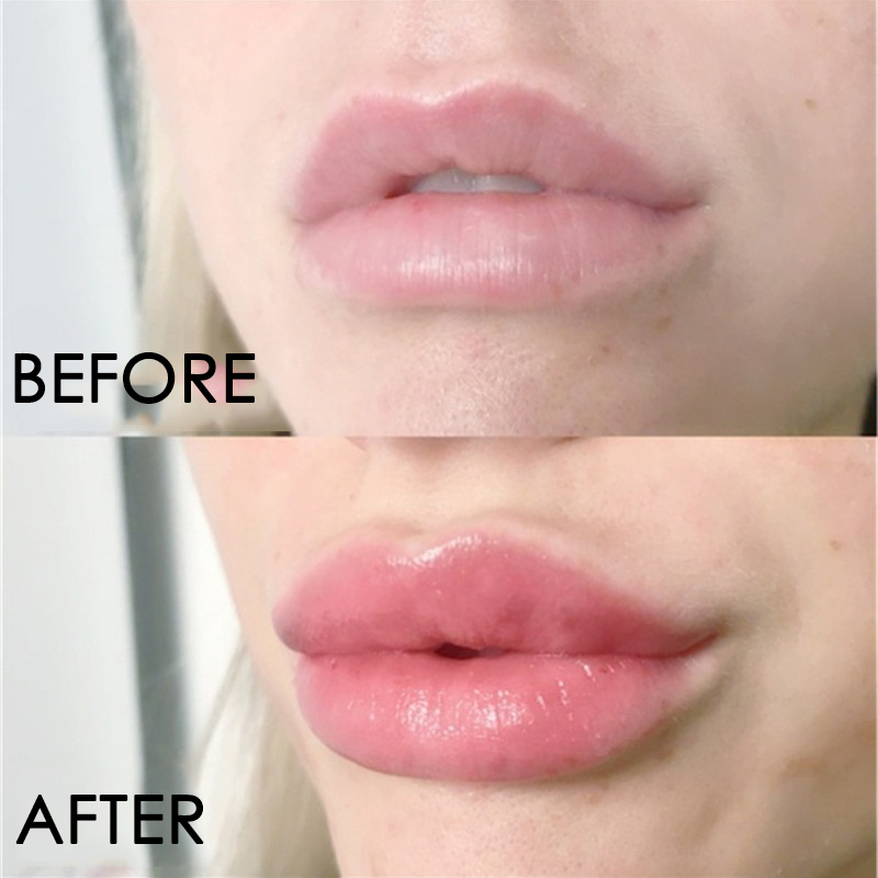 Serum Perawatan Bibir Instan P - Lip Gloss Plumping ulasan dan harga
